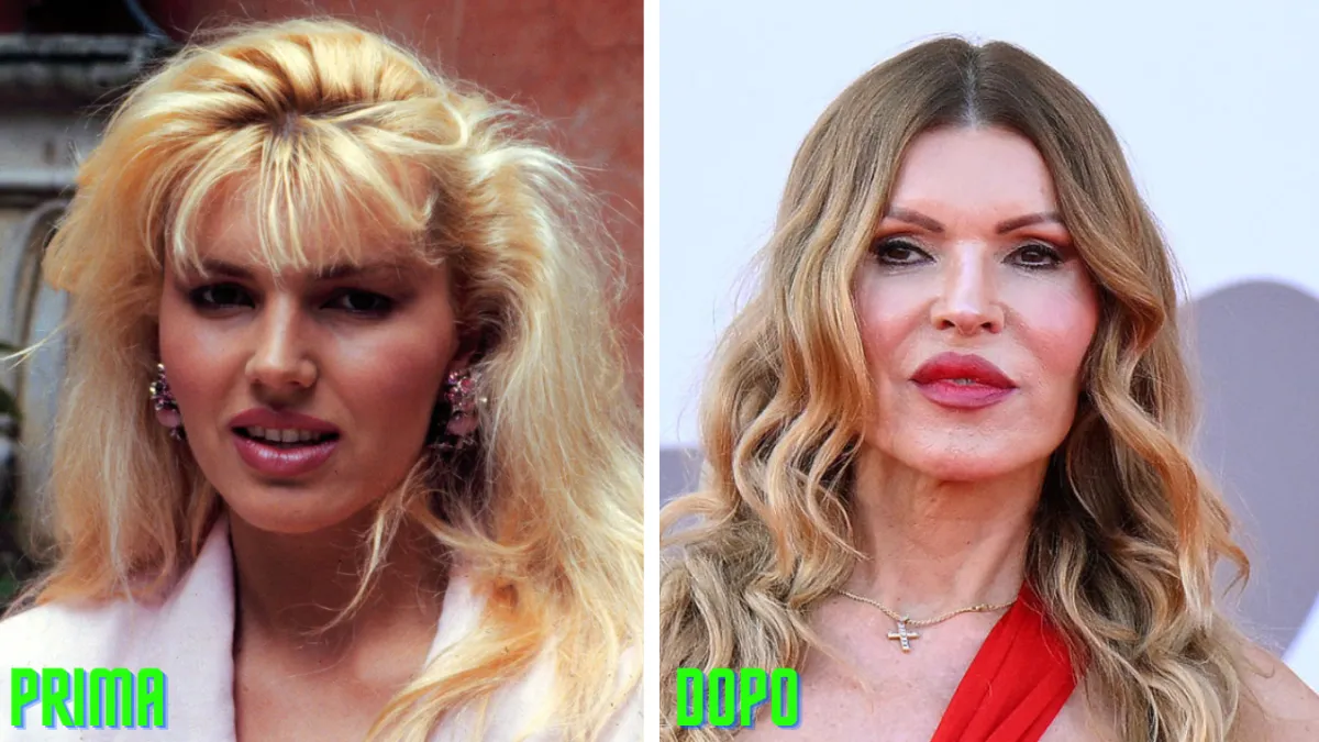 Rita Rusic è rifatta? La verità dalla foto prima e dopo