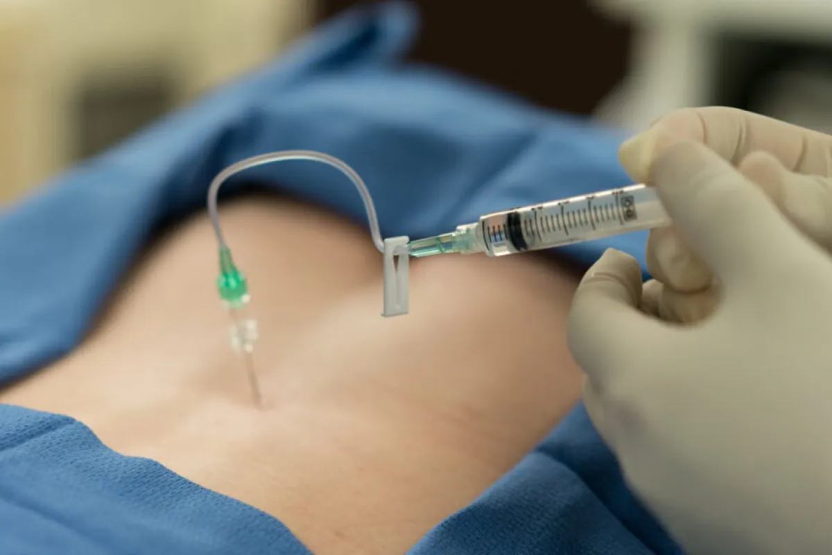 Epidurale e movimento: una nuova esperienza del parto 