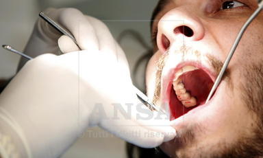 Pulizia dei denti