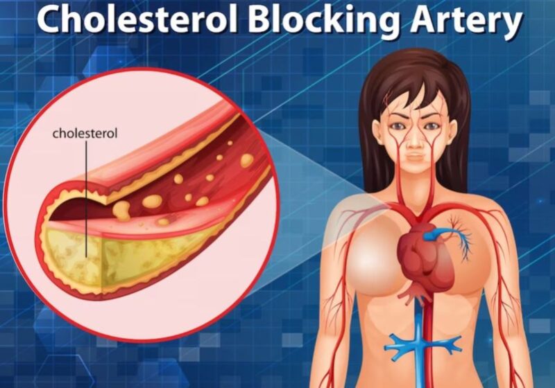 Quali cibi rallentano il colesterolo